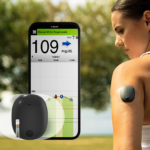 Eversense 365 - Image 3