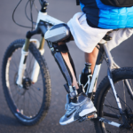 C-Brace Leg Orthosis - Image 4