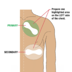 VitalPatch RTM Biosensor - Image 3